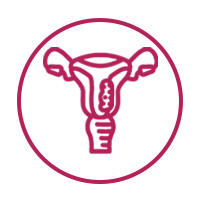 Uterine Cancer